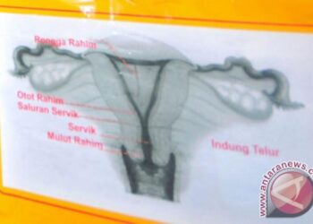 Dokter di India Berhasil Mengangkat Tumor Terbesar di Dunia