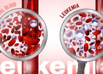 Deteksi Dini Leukemia pada Anak Bantu Kurangi Risiko Kematian